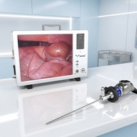 Système portable médical de caméra endoscopique chirurgicale électrique YKD-9119T HD avec sortie résolution 21MP pour usage ORL