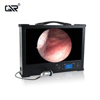 Cámara endoscópica Full HD portátil de 24 pulgadas para equipo de cirugía ENT/Urología/laparoscopia/histeroscopia/cistoscopia