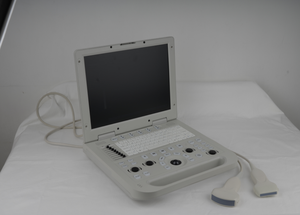 Equipo <span class=keywords><strong>de</strong></span> Diagnóstico Veterinario <span class=keywords><strong>de</strong></span> Ultrasonido Negro, <span class=keywords><strong>Precio</strong></span> <span class=keywords><strong>de</strong></span> Fábrica, Gran Venta - Product Image 6