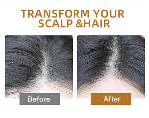 Shampoo liquide nourrissant et lissant anti-pelliculaire spécifique pour enfants - Product Image 6