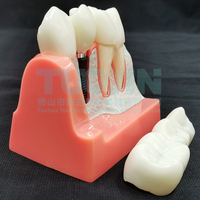 Modèle d'implant dentaire, couronne, pont, modèle amovible, modèle de dents en porcelaine, modèle de démonstration dentaire pour l'enseignement des dentistes