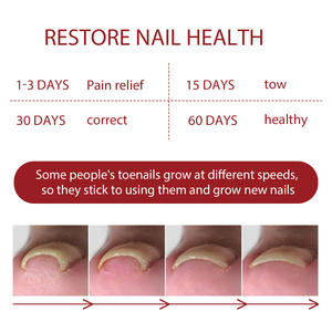 Renouvellement des ongles Extra Force Fungus Toe Fingails Repair Liquid Renew Endommagé Cassé Nail 7 Days Nail Fungus Treatment - Product Image 2