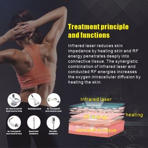 Máquina de Rejuvenecimiento Facial Vela III 3 de Newlife a <span class=keywords><strong>Precio</strong></span> de Fábrica, Máquina de Terapia Endosférica Vella Shape, Máquina Adelgazante Vela - Product Image 4