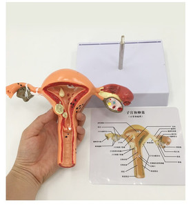 แบบจำลองการฝึกขยายขนาดมดลูกสำหรับวิทยาศาสตร์การแพทย์ สาขาวิชาพยาธิวิทยา แบบจำลองมดลูกสำหรับโรงเรียนแพทย์ - Product Image 3