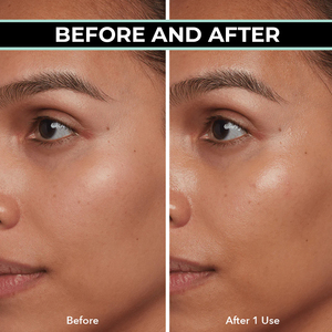 Ensemble de soins de la peau coréens de marque privée pour les peaux sensibles Soulagement naturel des rougeurs Crème de sérum pour le visage Inspiration acide hyaluronique Sève de bouleau - Product Image 5