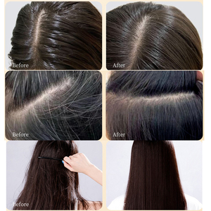 Natural Anti-pérdida de cabello Cabello negro <span class=keywords><strong>Caspa</strong></span> limpia Mejora <span class=keywords><strong>la</strong></span> salud Cuero cabelludo Sin estimulación Polygonum Multiflorum Jabón para el cabello - Product Image 5