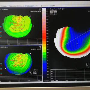 Instrumento Multifuncional de Topografía Corneal SW6000, Detector de Topografía Corneal para Clínica Oftalmológica, <span class=keywords><strong>Astigmatismo</strong></span>, Forma de la Córnea - Product Image 5