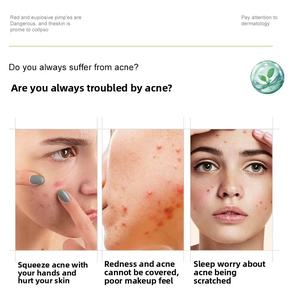 カスタムロゴ新デザインにきびスポットパッチティーツリーオイルにきびヒーリングパッチスキンケア用 - Product Image 5