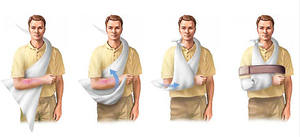 ผ้าพันแผลสามเหลี่ยมที่ไม่ทอสำหรับสลิงแขนผ้าโปร่งดูดซับทางการแพทย์หลายขนาด - Product Image 6