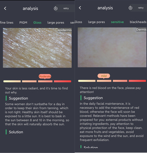 Manejar Wifi Microscopio Belleza Analizador facial Equipo detector Inalámbrico WIFI Tri Spectral AI Analizador de piel inteligente - Product Image 4