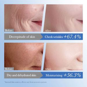 SADOER Nettoyant Visage Hydratant Bio au Caviar et Acide Hyaluronique, Nettoyage en Profondeur, Contrôle des Points Noirs et Sébum - Product Image 4
