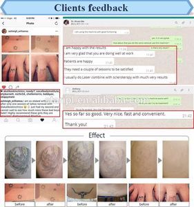 Fabriek Prijs Pico Tweede Carbon Peeling Q-Switched Laser 1064 1320 532 + 755nn + Zicht Machine Voor Nd Yag Tattoo Verwijdering - Product Image 5