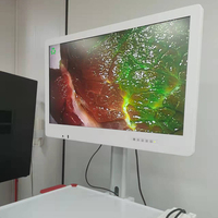 Monitor medis melengkung 32 inci untuk kamera endoskopi medis