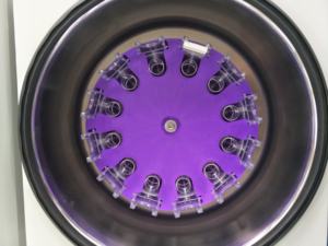 CYJ-6 세포 도말 Cytospin 임상 원심 분리기 3000rpm RCF 730xg 원심 분리기 - Product Image 2