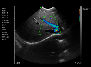 Konted MDR Venta caliente precio de fábrica portátil color doppler sonda de ultrasonido - Product Image 5