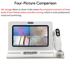 Analyseur de peau du cuir chevelu et du visage portable <span class=keywords><strong>3D</strong></span> HD de haute qualité avec prise américaine pour usage commercial - Product Image 4