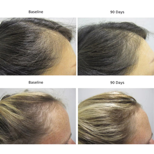 Oem phụ nữ của Amino Biotin phức tạp tăng trưởng tóc máy tính bảng cho người lớn sử dụng sản phẩm làm đẹp collagen tăng trưởng tóc thảo dược bổ sung - Product Image 2