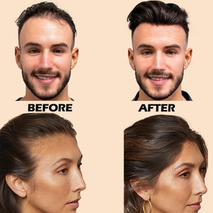 Spray Fijador de Fibras Capilares de Secado Rápido, Mejora la Fijación entre las Fibras Capilares y el Cabello Fino, Aspecto Natural, Bruma Fijadora de Fibras Capilares - Product Image 5