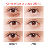 Suero Revitalizante para Ojos, Anti-Ojeras, Hidratante de Grado Cosmético, Vegano, Reduce las Ojeras