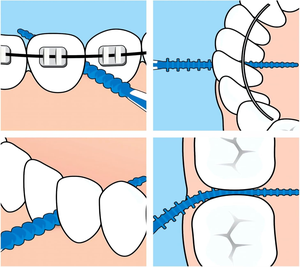 Palillos de Dientes Suaves, Cepillos Interdentla de Goma de Silicona, Cerdas Finas, Espacios Profundos en los Dientes, <span class=keywords><strong>Cepillo</strong></span> <span class=keywords><strong>Interdental</strong></span> - Product Image 4