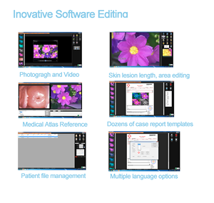 Colposcope numérique vidéo KN-2200A avec trépied pour caméra vaginale CCD Sony – <span class=keywords><strong>Prix</strong></span> du colposcope numérique - Product Image 6