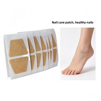 Patch de Correction d'Ongles Incarnés en Forme de T, Autocollant Flexible et Sûr, Soutien d'Alignement, Prévention, Marque Privée
