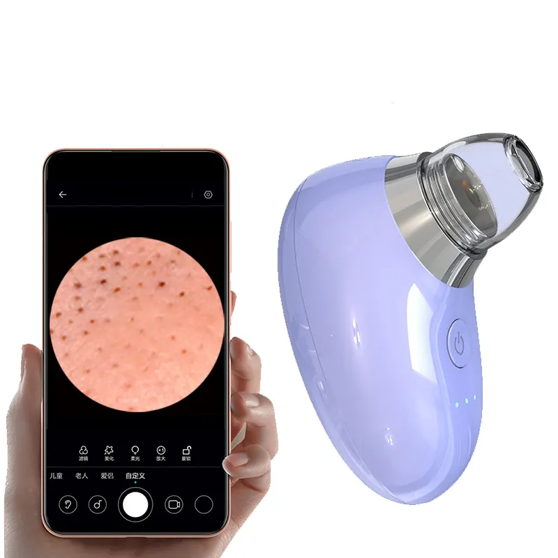 Professional Pore Cleaner Vacuum Electric Nose Face Pore Acne Deep Cleaner Visible Blackhead Remover Vacuum With Camera