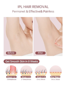 LIDE 여성용 가정용 <span class=keywords><strong>IPL</strong></span> 제모 기계 레이저 미용 장비 아이스 냉각 전신 제모기 저렴한 RV 응용 프로그램 - Product Image 5