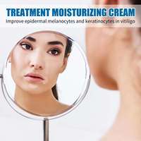 Crème corporelle OEM pour estomper les taches, éclaircir le teint et traiter le vitiligo, à base d'ingrédients chinois