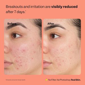 Spray Réparateur Lance Fix All : Purifie, Apaise, Soulage les Boutons, les Stressants et les Rougeurs – Acide Hypochloreux, <span class=keywords><strong>Eau</strong></span> Électrolytique, Biologique, Végétalien - Product Image 4