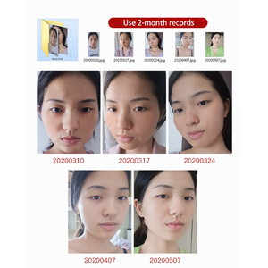 Crème éclaircissante pour le <span class=keywords><strong>visage</strong></span> de jour et de nuit OEM, meilleure crème éclaircissante pour la peau en Malaisie, crème éclaircissante pour hommes - Product Image 5