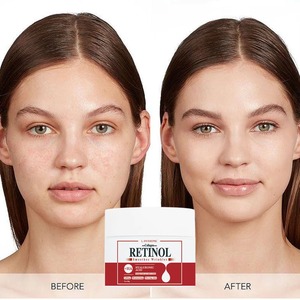 <span class=keywords><strong>Crema</strong></span> Antiarrugas Facial en Oferta, Aclara el Tono de Piel Sin Irritación, Antienvejecimiento, Elimina Arrugas, <span class=keywords><strong>Crema</strong></span> con Retinol - Product Image 3