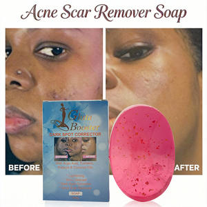 สบู่ก้อนสมุนไพรธรรมชาติ OEM ที่ดีที่สุด ผสมกรดโคจิก ช่วยลดรอยสิว จุดด่างดำ ฝ้า กระ พร้อมสารสกัดจากมะละกอและน้ำมันมะพร้าว - Product Image 2