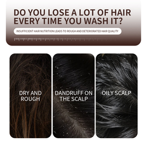 Greenlem Polygonum Multiflorum Tự Nhiên Làm Bằng Tay Thảo Dược Than Kojic Axit Nghệ Đen Xà Phòng Thanh Rắn - Product Image 3