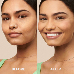 Cura della pelle lumaca maschera viso idratazione Anti-invecchiamento per la pelle a tendenza Acne - Product Image 5