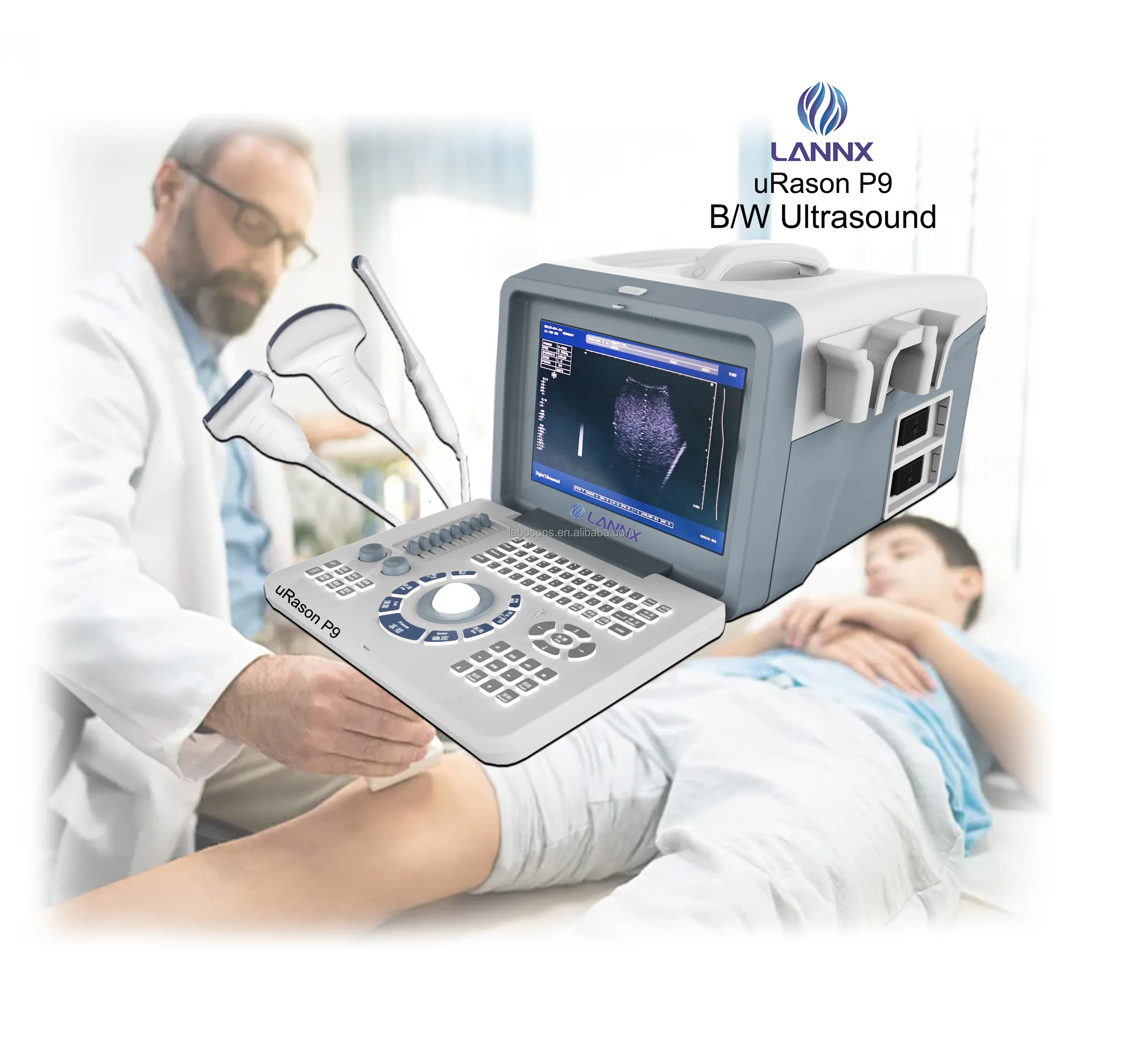 LANNX uRason P9 insan 2D için yeni tasarım hastane ekipmanları ultrason makinesi ultrasonik tanı tarama ekografi