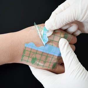 Tıbbi PU su geçirmez bant tek kullanımlık steril Bedsores yara şeffaf Film yapışkan bant tıbbi yara pansuman Fixer rulo - Product Image 6