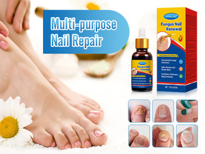 2025 Venta caliente OEM ODM onicomicosis eliminar <span class=keywords><strong>hongos</strong></span> y mejorar las uñas <span class=keywords><strong>de</strong></span> los <span class=keywords><strong>pies</strong></span> y las uñas líquido cuidado <span class=keywords><strong>de</strong></span> las uñas <span class=keywords><strong>de</strong></span> los <span class=keywords><strong>pies</strong></span> - Product Image 4