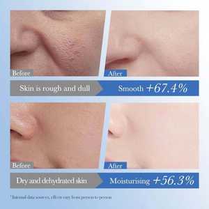 Crème hydratante pour le visage à l'acide hyaluronique, lotion nourrissante pour la peau, soin anti-âge, éclaircissant, à base de céramide, de qualité supérieure, en promotion - Product Image 3