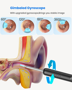 Otoscopio Bebird 2024 con Cámara 1080P, Endoscopio Visual para el Cuidado de la Salud del Oído, Nariz y Garganta con Herramienta para Extraer Cera del Oído - Product Image 6