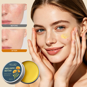 Baume Correcteur Anti-Imperfections Soin des Boutons Hydratant Réparateur Peau Lisse Produits de Beauté Baume de Nuit Anti-Points Noirs - Product Image 4