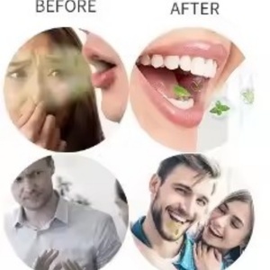 Spray Bucal FUREIN SMILE para el Mal Aliento, Venta al Por Mayor - Product Image 3