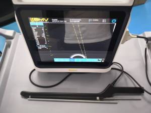 Advanced PT60 OPU para IVF-High Resolution (120dB) <span class=keywords><strong>Cine</strong></span> Loop 200 Frames, Bluetooth Keyboard Ready BMV OPU System Ultrasonido - Product Image 4