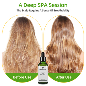 Aceite Esencial Revitalizante de Salvia a Base de Plantas de 30 ml, Regula el Exceso de Grasa, Hidratación Profunda, Equilibrio de <span class=keywords><strong>la</strong></span> Grasa, Reduce el Cabello <span class=keywords><strong>Roto</strong></span>, Curación Profunda - Product Image 1