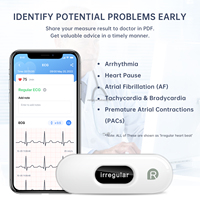 Prix du moniteur Ecg Viatom Holter Ecg Connexion Bluetooth sans fil Mini moniteur Ekg portable Moniteur Ecg portable