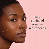 Patchs Hydrocolloïdes Anti-Acné Points et Imperfections, avec Granules d'Acide Salicylique, Invisibles, Emballage Carton Imprimé Cœur