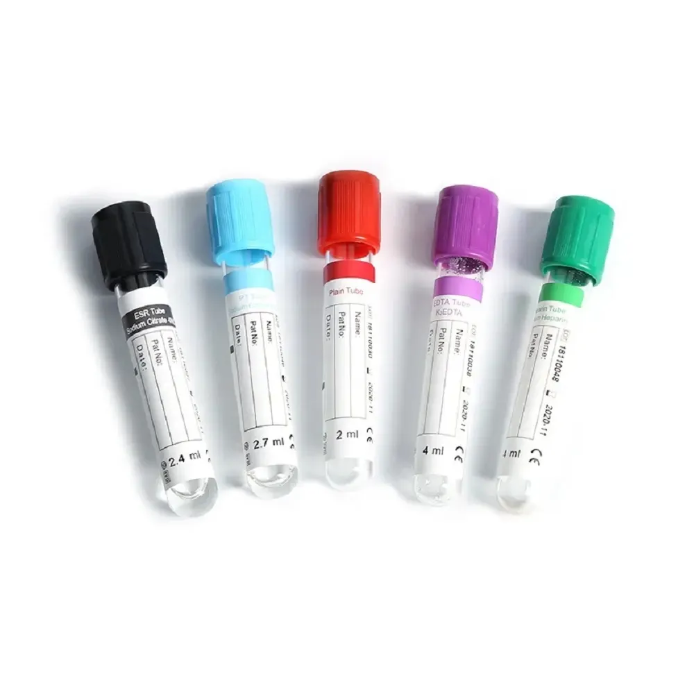 Os tubos plásticos estéreis do teste 5ml com tampas do parafuso polipropileno recipiente graduaram o tubo da amostra do sangue