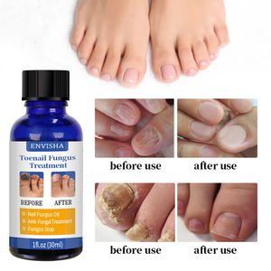 Perawatan Kuku Jamur Perawatan Kaki Kuku Pemutih Jari Kaki Kuku Penghilang Jamur Gel Anti Infeksi Paronychia Onychomycosis - Product Image 2