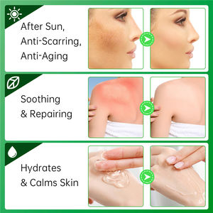 SEFUDUN Hidratante Suavizante Aceite reparador Control de <span class=keywords><strong>manchas</strong></span> de acné Tratamiento de poros grandes Gel <span class=keywords><strong>puro</strong></span> de <span class=keywords><strong>aloe</strong></span> <span class=keywords><strong>vera</strong></span> <span class=keywords><strong>para</strong></span> <span class=keywords><strong>cara</strong></span> y cuerpo - Product Image 3