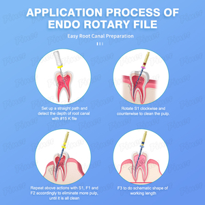 Nha khoa màu xanh tập tin <span class=keywords><strong>endo</strong></span> kênh gốc tập tin chuyển động đối ứng tập tin điều trị nội nha - Product Image 3